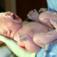 Neonato parto 200