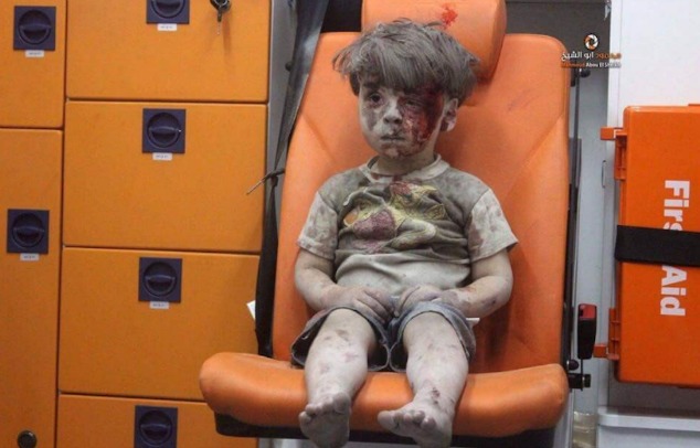 bambino ferito aleppo