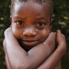 congo malnutrizione
