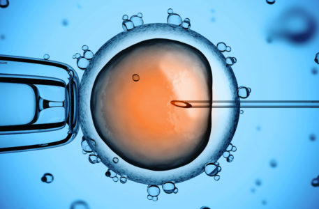 Fecondazione. Quella artificiale porta 8 coppie su 10 a una cocente delusione