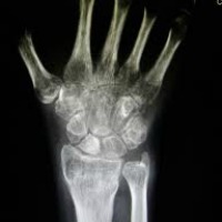 radiografia